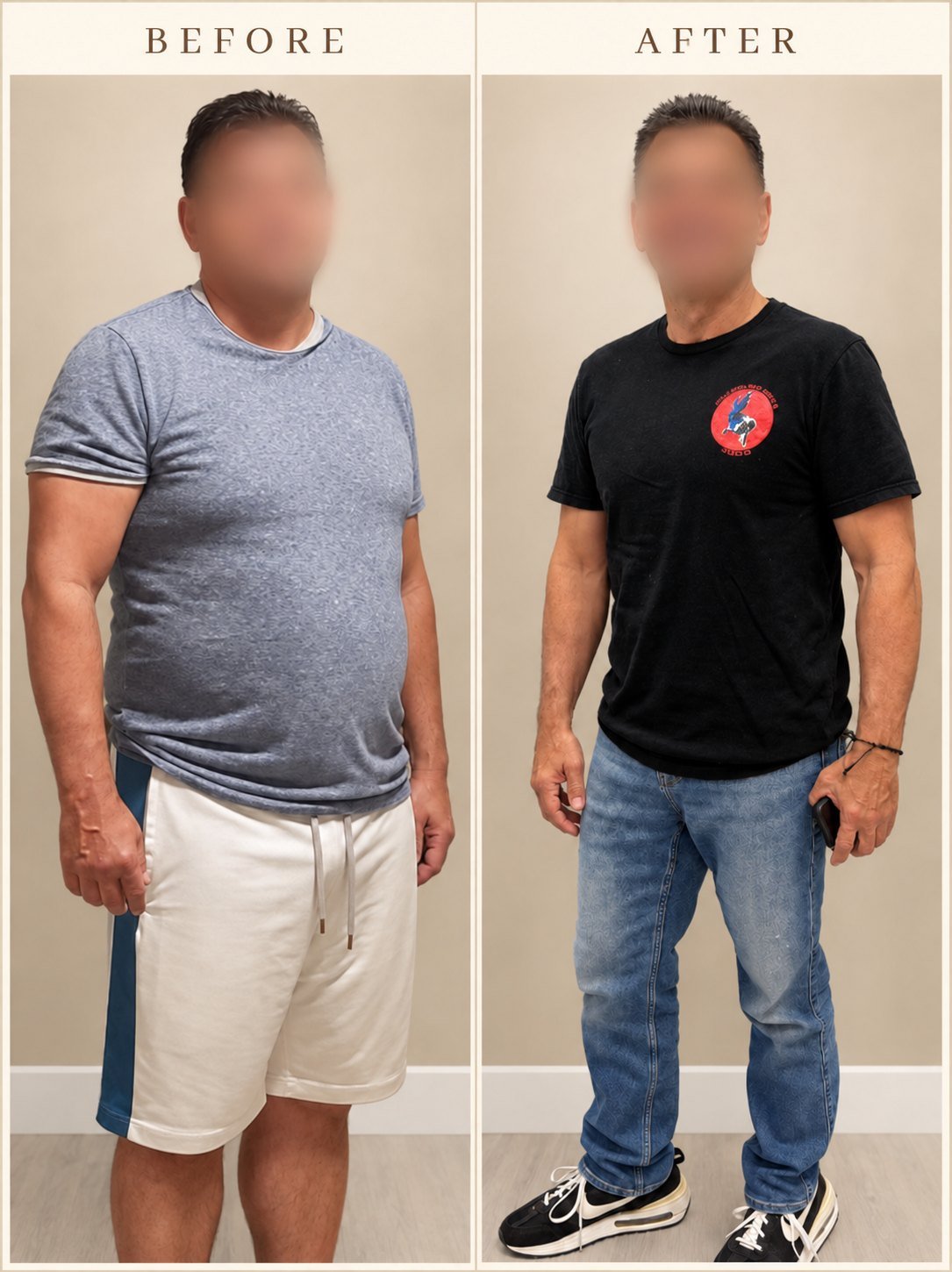Before and after of a medical weight loss patient with a visibly slimmer waist, face blurred for privacy